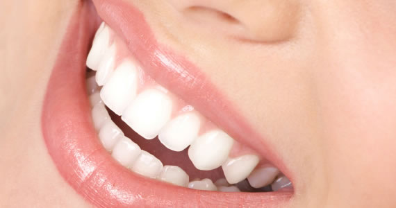 Why Regular Teeth Cleaning is Important